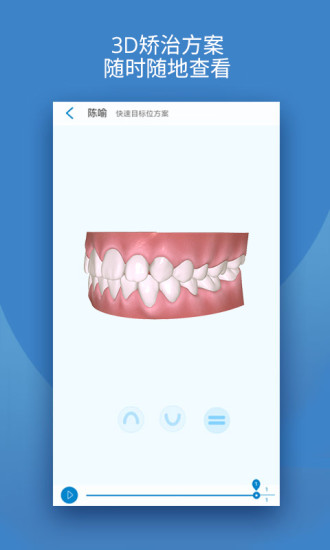 iOrtho时代天使APP高清大图